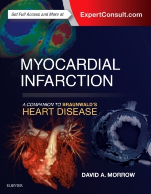 Bilde av Myocardial Infarction: A Companion To Braunwald&#039;s Heart Disease Av David A Md Mph (director Levine Cardiac Intensive Care Unit Cardiovascular Div