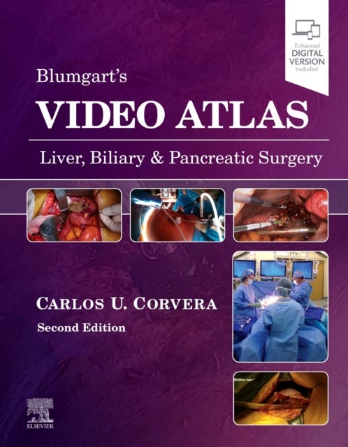 Bilde av Video Atlas: Liver, Biliary &amp; Pancreatic Surgery Av Carlos (professor Of Surgery Chief Of Hepatobiliary And Pancreatic Surgery Maurice Galante Dis