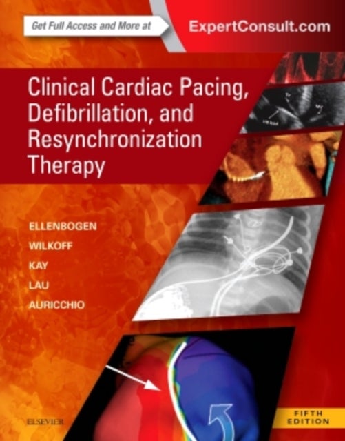 Bilde av Clinical Cardiac Pacing, Defibrillation And Resynchronization Therapy Av Kenneth A. (kontos Professor Of Medici Ellenbogen