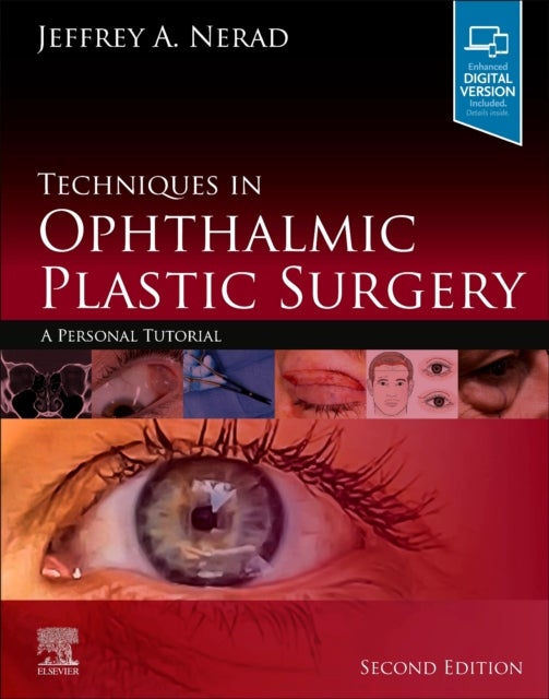 Bilde av Techniques In Ophthalmic Plastic Surgery Av Jeffrey A. (partner Cincinnati Eye Institute Nerad, University Of Cincinnati Cincinnati Ohio) Professor Of