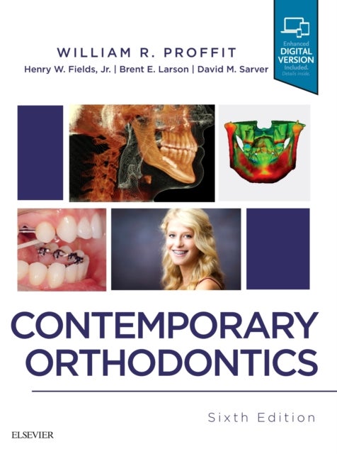 Bilde av Contemporary Orthodontics Av William R. (department Of Orthodontics School Of Dentistry University Of North Carolina Chapel Hill Nc) Proffit, Henry Dd