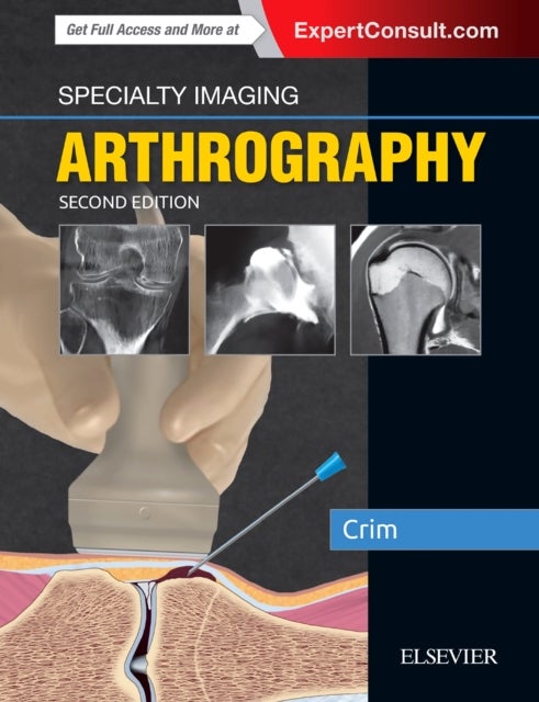 Bilde av Specialty Imaging: Arthrography Av Julia R. Md (chief Of Musculoskeletal Radiology Vice Chair For Clinical Affairs Professor Of Radiology University O
