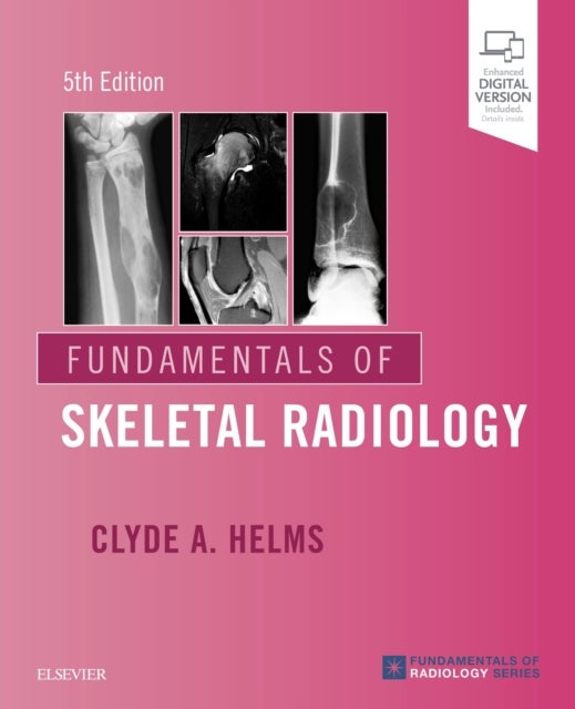 Bilde av Fundamentals Of Skeletal Radiology Av Clyde A. (professor Of Radiology And Orthopaedic Surgery Deparment Of Radiology Duke University School Of Medici