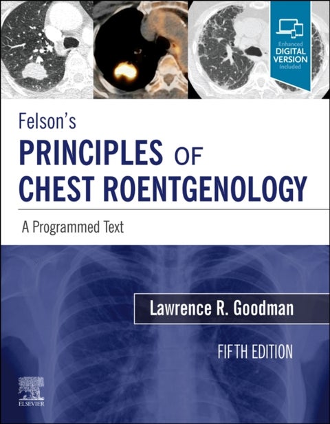 Felson's Principles of Chest Roentgenology, A Programmed Text - A Programmed Text