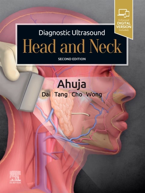 Bilde av Diagnostic Ultrasound: Head And Neck Av Anil T. (professor Of Diagnostic Radiology &amp; Organ Imaging Faculty Of Medicine The Chinese University Of H