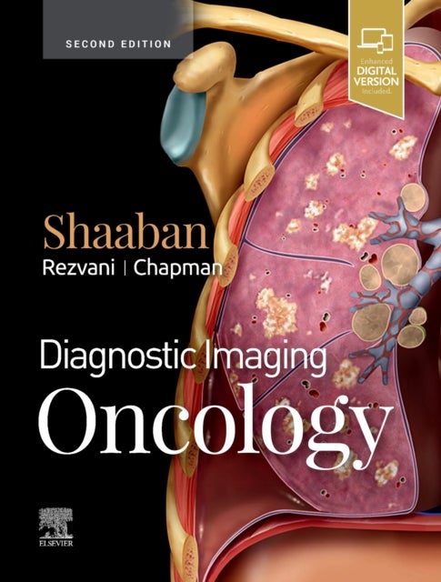 Bilde av Diagnostic Imaging: Oncology Av Akram M. Shaaban