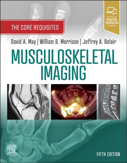 Bilde av Musculoskeletal Imaging Av David A. (radiology Associates Richmond Va May, Department Of Radiology Virginia Commonwealth University Medical College Of