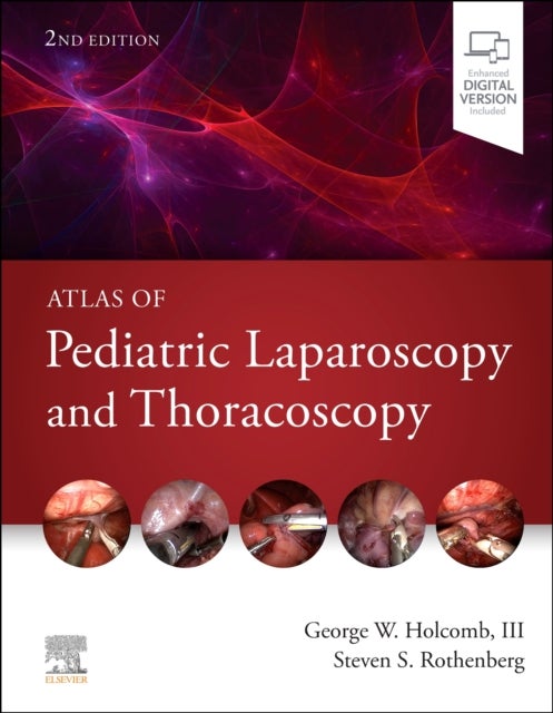 Bilde av Atlas Of Pediatric Laparoscopy And Thoracoscopy