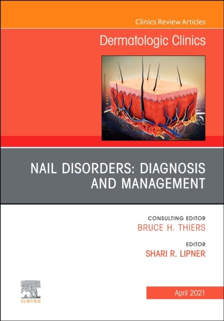 Bilde av Nail Disorders: Diagnosis And Management, An Issue Of Dermatologic Clinics