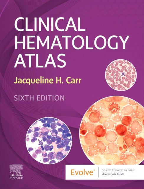 Bilde av Clinical Hematology Atlas Av Jacqueline H. Carr