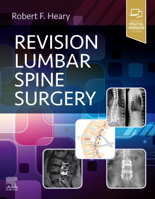 Bilde av Revision Lumbar Spine Surgery