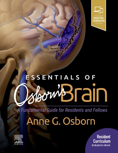 Bilde av Essentials Of Osborn&#039;s Brain Av Anne G. Md (william H. And Patricia N. Child Presidential Endowed Chair Honoring Pioneering Utah Women In Medicin