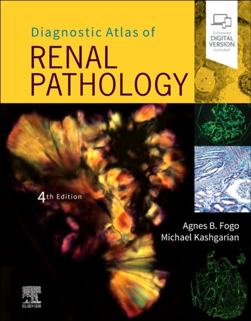 Bilde av Diagnostic Atlas Of Renal Pathology Av Agnes B. (professor Of Pathology Medicine And Pediatrics Director Renal Electron Microscopy Laboratory Vanderbi