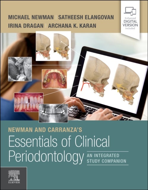 Bilde av Newman And Carranza&#039;s Essentials Of Clinical Periodontology