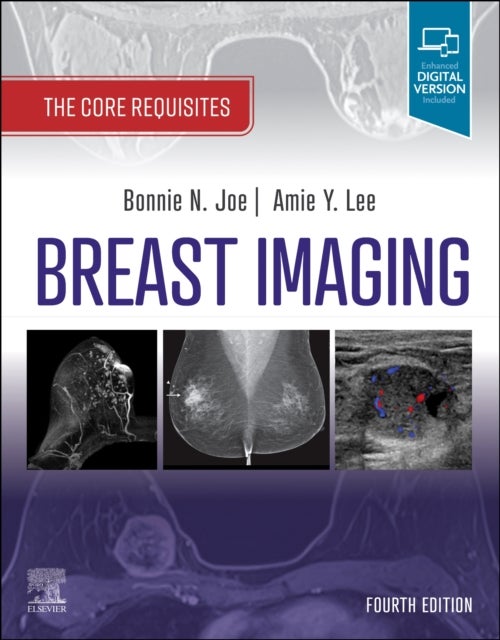 Bilde av Breast Imaging Av Bonnie N. (professor Radiology&lt;br&gt;chief Breast Imaging&lt;br&gt;department Of Radiology And Biomedical Imaging&lt;br&gt;univer