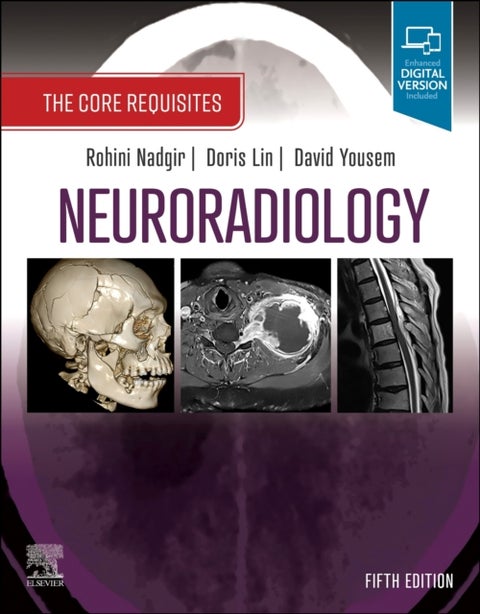 Neuroradiology - The Core Requisites