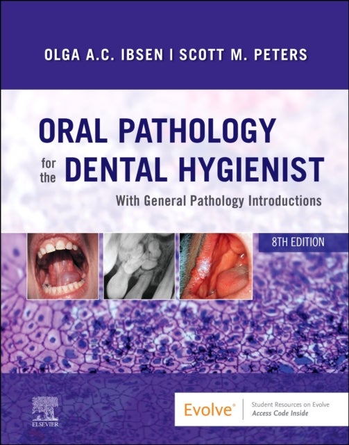 Bilde av Oral Pathology For The Dental Hygienist Av Olga A. C. (adjunct Professor&lt;br&gt;department Of Oral And Maxillofacial Pathology Radiology And Medicin