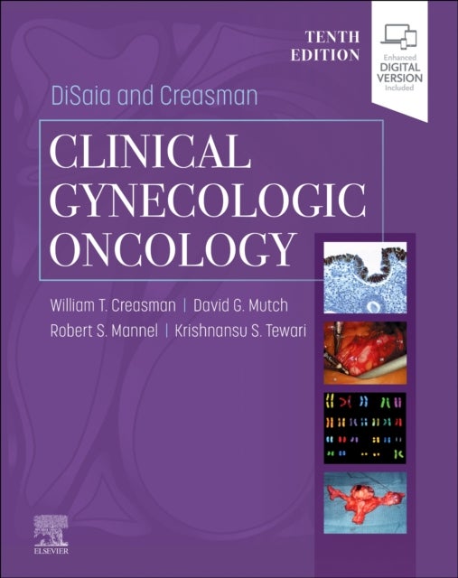 Bilde av Disaia And Creasman Clinical Gynecologic Oncology