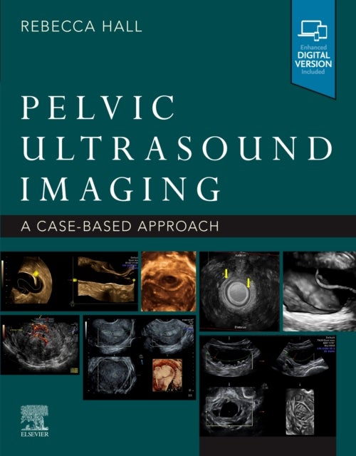 Bilde av Pelvic Ultrasound Imaging