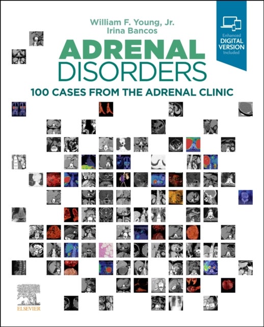 Bilde av Adrenal Disorders Av William F. (division Of Endocrinology Diabetes Metabolism And Nutrition Tyson Family Endocrinology Clinical Professor Young, Mayo