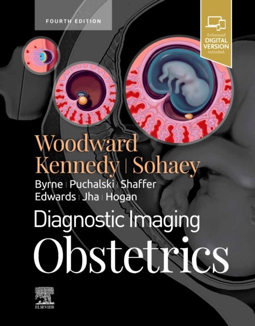 Bilde av Diagnostic Imaging: Obstetrics Av Paula J. (professor In The Department Of Radiology And Adjunct Professor Of Obstetrics And Gynecology At The Univers