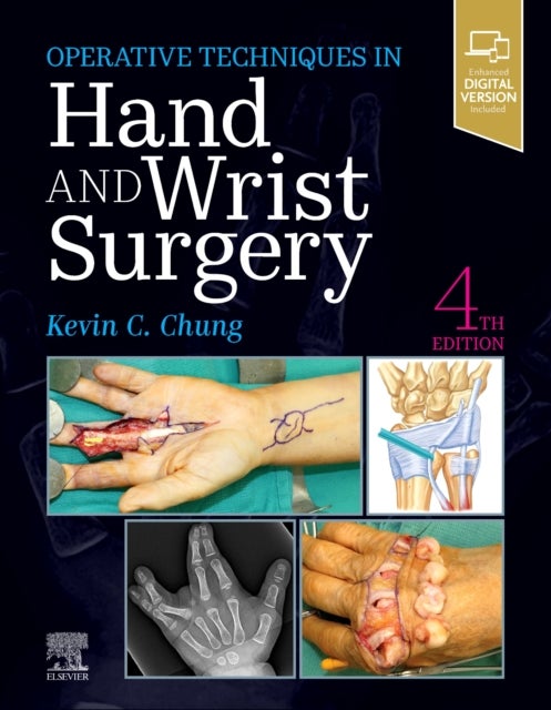 Bilde av Operative Techniques: Hand And Wrist Surgery Av Kevin C. (charles B.g. De Nancrede Professor In Surgery Section Of Plastic Surgery Chung, Associate Di