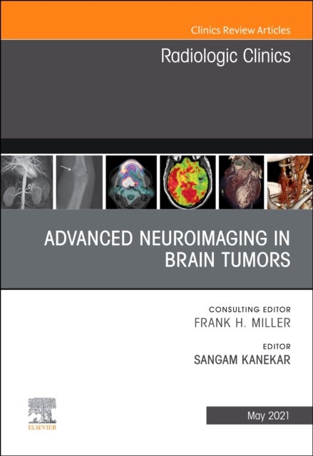 Bilde av Advanced Neuroimaging In Brain Tumors, An Issue Of Radiologic Clinics Of North America