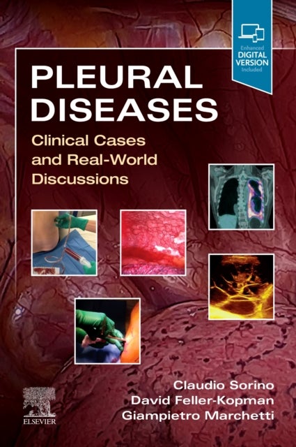 Pleural Diseases - Clinical Cases and Real-World Discussions