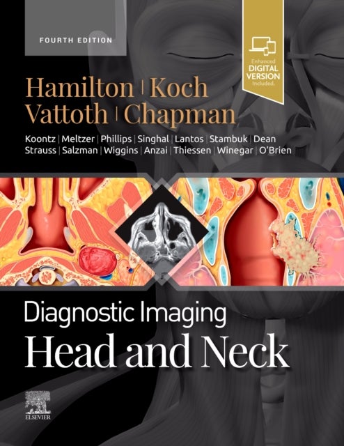 Bilde av Diagnostic Imaging: Head And Neck Av Bernadette L. (associate Director Of Radiology Cincinnati Children&#039;s Hospital Medical Center Professor Of Ra