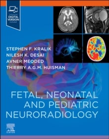 Bilde av Fetal, Neonatal And Pediatric Neuroradiology Av Stephen (department Of Radiology Texas Childrens Hospital Houston Texas Usa) Kralik, Nilesh (departmen