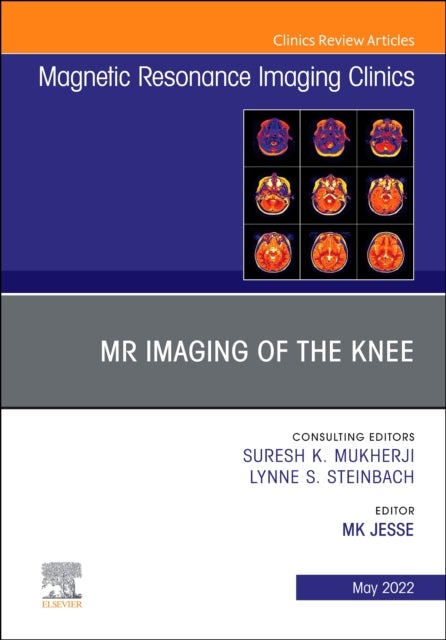 Bilde av Mr Imaging Of The Knee, An Issue Of Magnetic Resonance Imaging Clinics Of North America