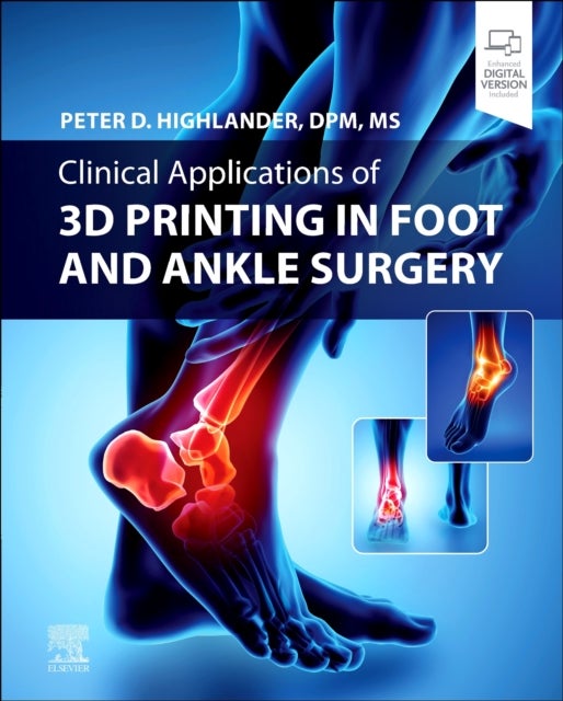 Bilde av Clinical Applications Of 3d Printing In Foot And Ankle Surgery Av Peter D. Dpm Ms Highlander