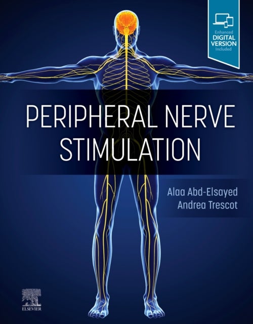 Bilde av Peripheral Nerve Stimulation Av Alaa Md Mph Fasa (medical Director Uw Pain Clinic Division Chief Chronic Pain Medicine University Of Wisconsin-madison