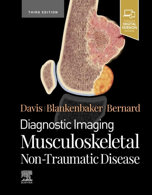 Bilde av Diagnostic Imaging: Musculoskeletal Non-traumatic Disease Av Kirkland W. (professor Of Radiology Musculoskeletal Imaging And Intervention Department O