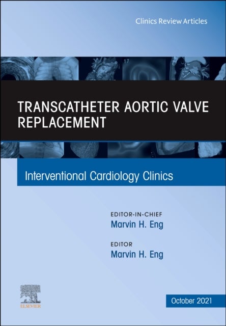 Bilde av Transcatheter Aortic Valve Replacement, An Issue Of Interventional Cardiology Clinics
