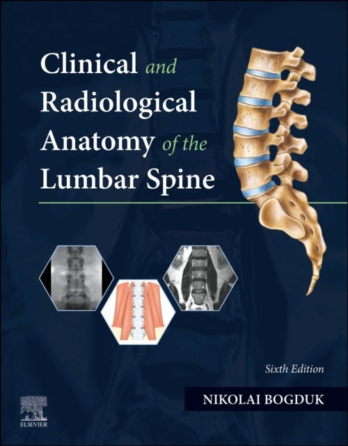 Bilde av Clinical And Radiological Anatomy Of The Lumbar Spine Av Nikolai Bogduk