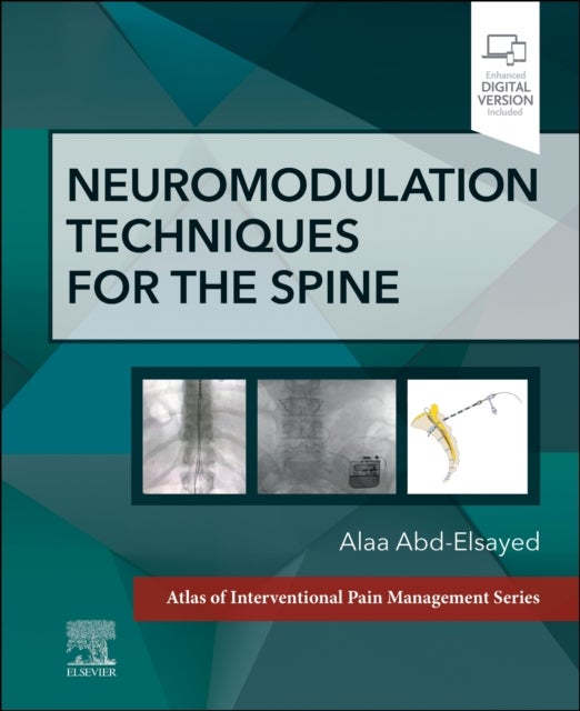 Bilde av Neuromodulation Techniques For The Spine Av Alaa Md Mph Fasa (medical Director Uw Pain Clinic Division Chief Chronic Pain Medicine University Of Wisco