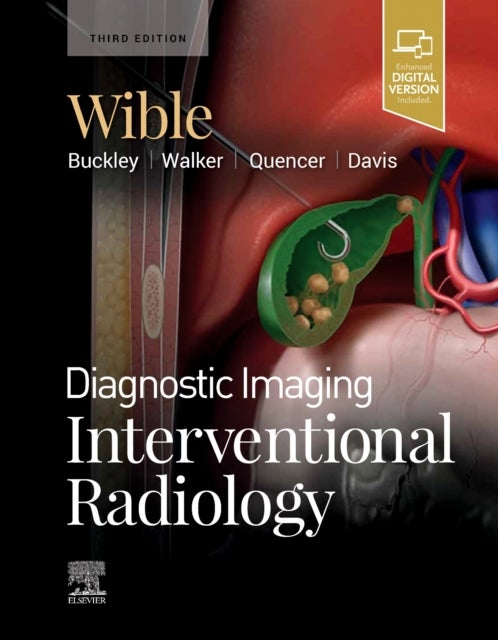Bilde av Diagnostic Imaging: Interventional Radiology Av Brandt C. (associate Professor Section Head Vascular &amp; Interventional Radiology University Of Miss