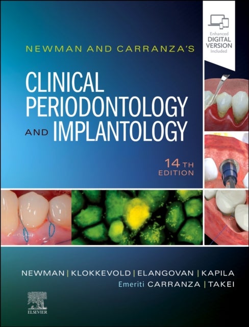 Bilde av Newman And Carranza&#039;s Clinical Periodontology And Implantology Av Michael G. (professor Emeritus Section Of Periodontics School Of Dentistry Univ