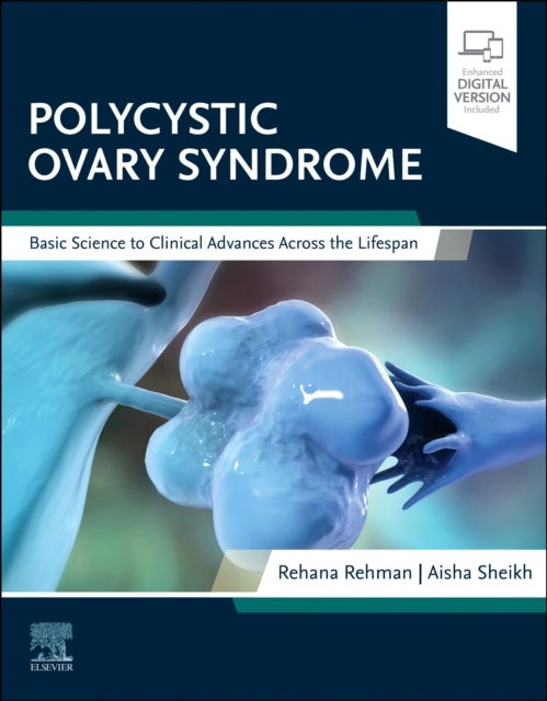 Bilde av Polycystic Ovary Syndrome
