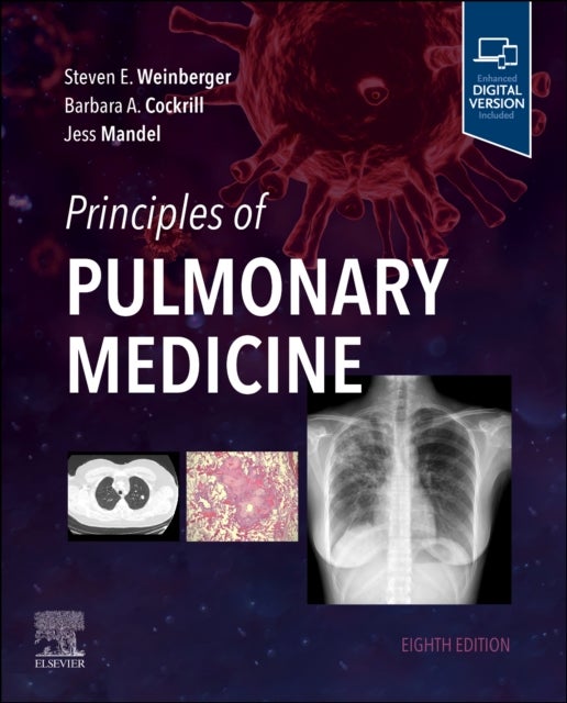 Bilde av Principles Of Pulmonary Medicine Av Steven E. (executive Vice President And Chief Executive Officer American College Of Physicians Weinberger, Perelma