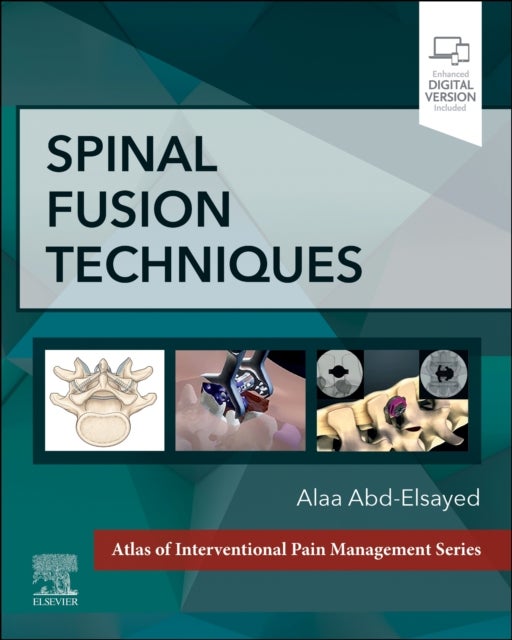 Bilde av Spinal Fusion Techniques Av Alaa Md Mph Fasa (medical Director Uw Pain Clinic Division Chief Chronic Pain Medicine University Of Wisconsin-madison Mad