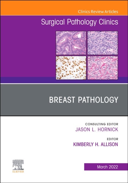 Bilde av Breast Pathology, An Issue Of Surgical Pathology Clinics