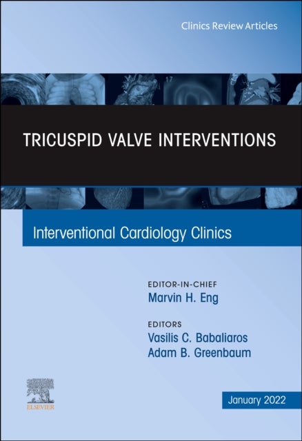 Bilde av Tricuspid Valve Interventions, An Issue Of Interventional Cardiology Clinics