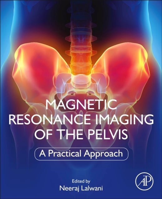 Bilde av Magnetic Resonance Imaging Of The Pelvis