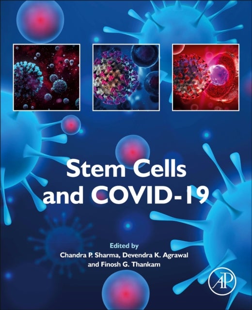 Bilde av Stem Cells And Covid-19