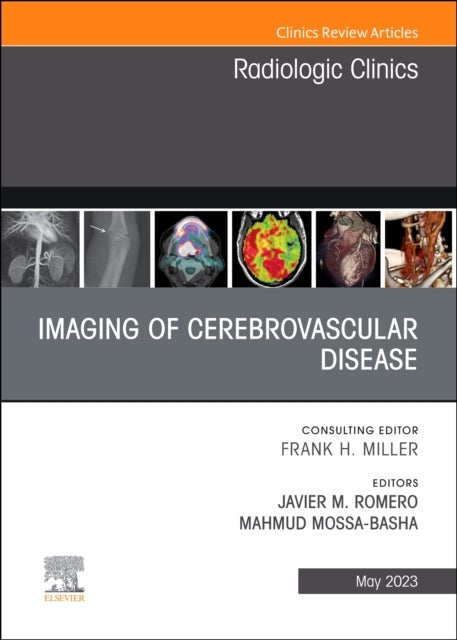 Bilde av Imaging Of Cerebrovascular Disease, An Issue Of Radiologic Clinics Of North America