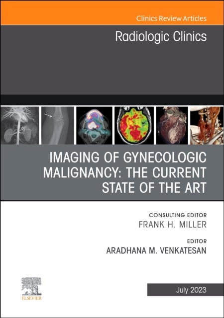 Bilde av Imaging Of Gynecologic Malignancy: The Current State Of The Art, An Issue Of Radiologic Clinics Of N