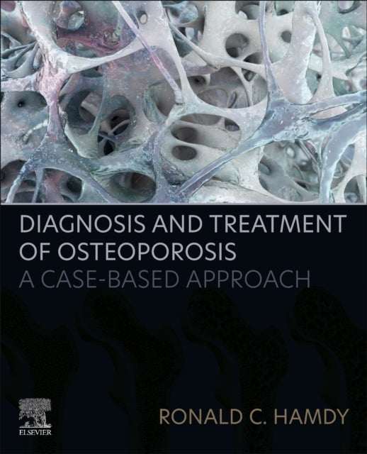 Diagnosis and Treatment of Osteoporosis - A Case-Based Approach