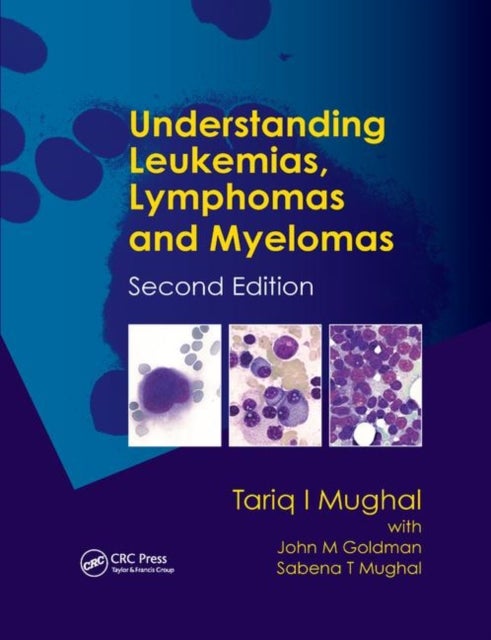 Bilde av Understanding Leukemias, Lymphomas And Myelomas Av Tariq I. (tufts University Medical Center Boston Massachusetts Usa Kings College Nhs Foundation Tru